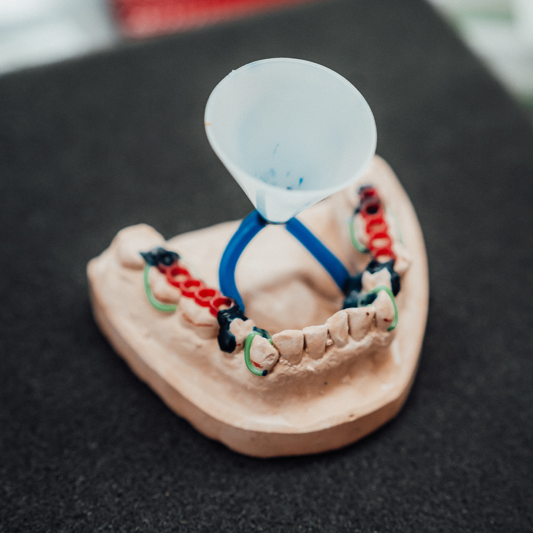 Leadgenerierung adfave - Vorbereiten der Protrusionsschiene mithilfe des Zahnabdrucks